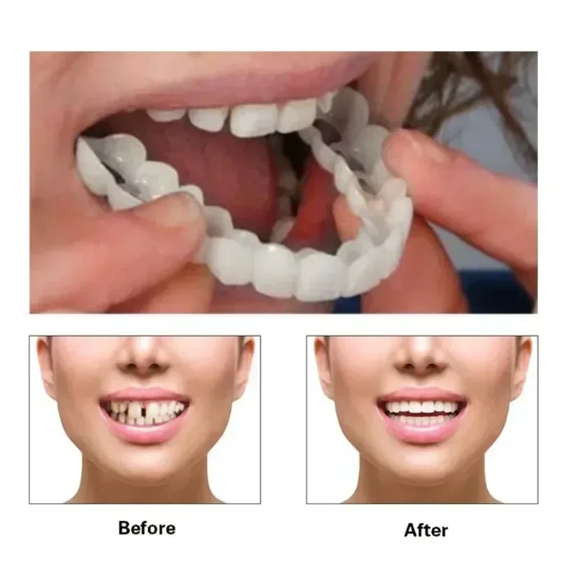 Perfect Fit Teeth Whitening Fake Tooth Cover Snap on Silicone Smile Veneers Teeth Upper Beauty Tool Reusable Cosmetic Teeth - Image 3