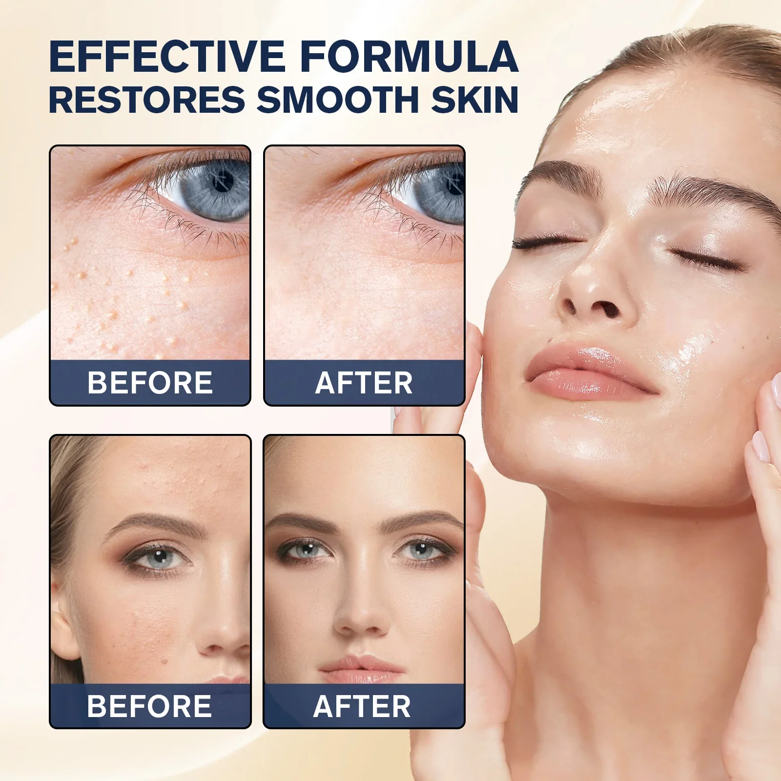 Milia Remover Essence Treatment Fat Granule Clearing Skin Hyaluronic Acid Deep Hydration and Gentle Exfoliation Hydrates Smooths - Image 2