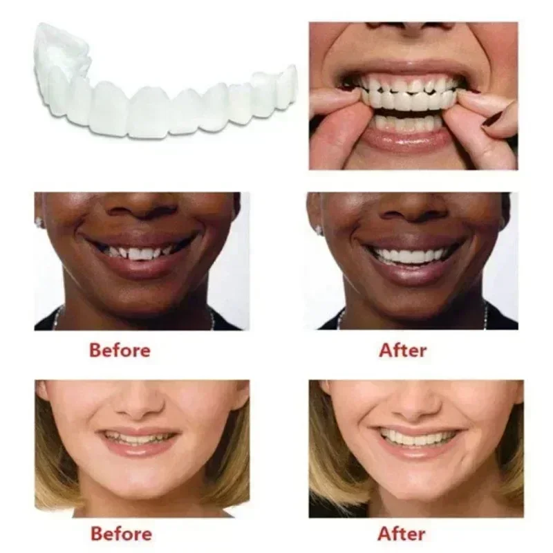 Perfect Fit Teeth Whitening Fake Tooth Cover Snap on Silicone Smile Veneers Teeth Upper Beauty Tool Reusable Cosmetic Teeth - Image 5